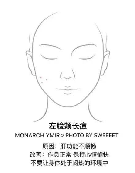 去痘痘的有效方法 怎么去痘痘的方法