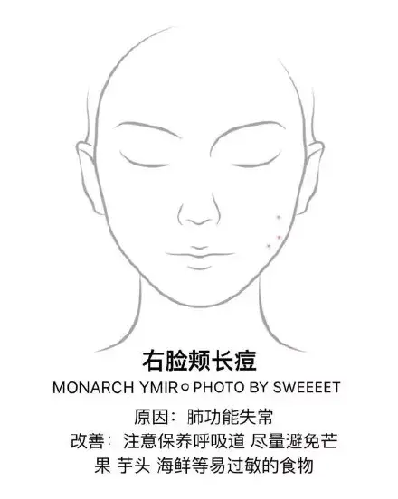 去痘痘的有效方法 怎么去痘痘的方法