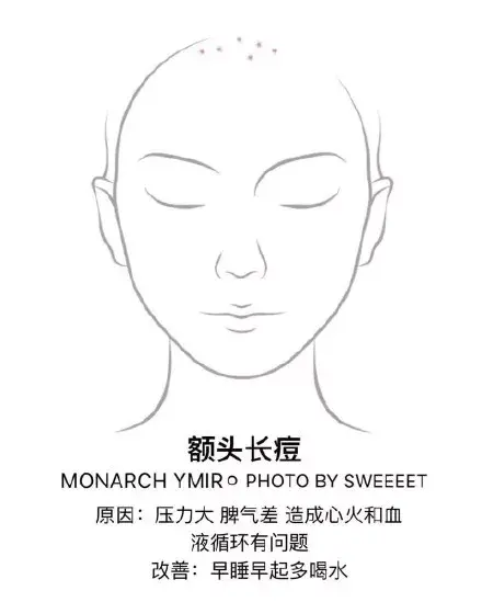 去痘痘的有效方法 怎么去痘痘的方法