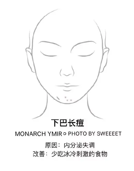 去痘痘的有效方法 怎么去痘痘的方法