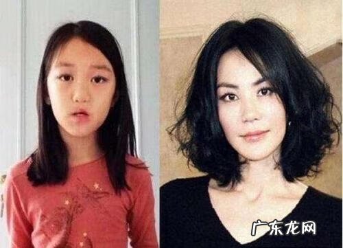 兔唇 图片 兔唇多少钱能看好