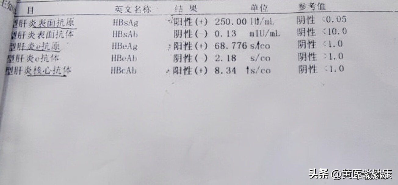 乙肝五项表面抗原弱阳性 乙肝表面抗原弱阳性是多少