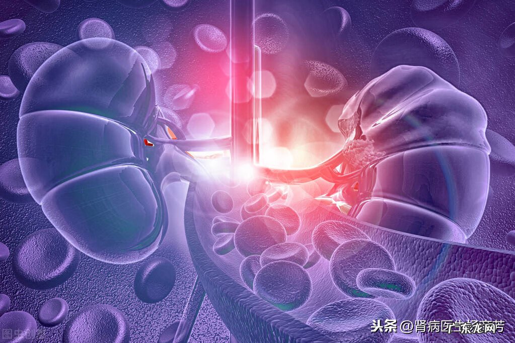 肾病综合症能治好吗 肾病综合征能治好吗?