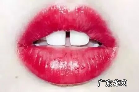 牙齿缝隙很大怎么办 牙齿缝隙大有什么说法
