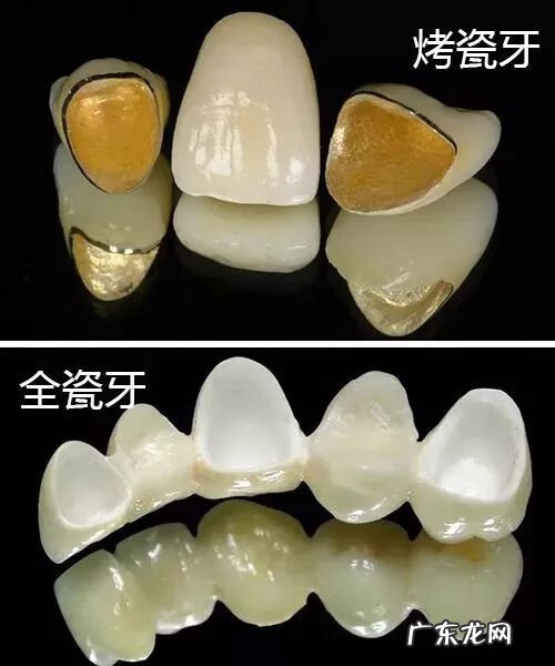 牙齿缝隙很大怎么办 牙齿缝隙大有什么说法