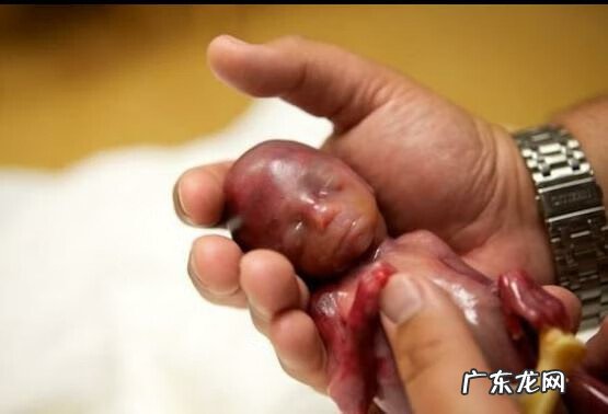 19周早产儿图片欣赏 19周早产儿