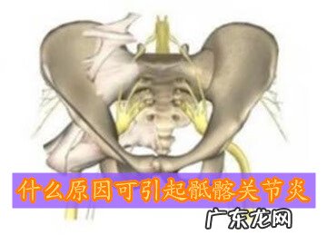 骶髂关节炎一般多久能好 骶髂关节炎是什么原因造成的