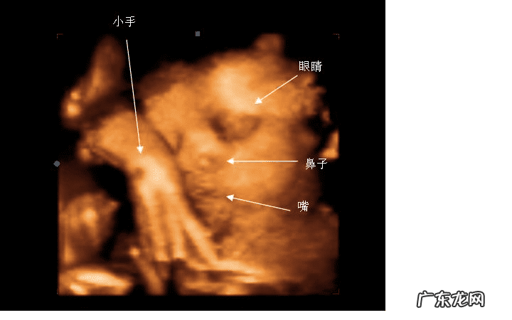 三维彩超价格 三维彩超多少钱一次