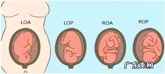 胎位ROA是什么位置 产检胎位roa是什么意思