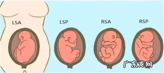 胎位ROA是什么位置 产检胎位roa是什么意思