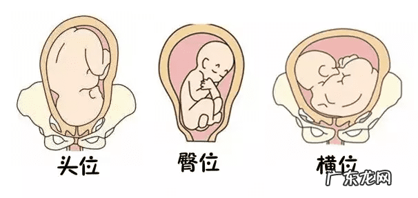 胎位ROA是什么位置 产检胎位roa是什么意思