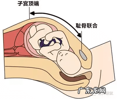 胎位ROA是什么位置 产检胎位roa是什么意思