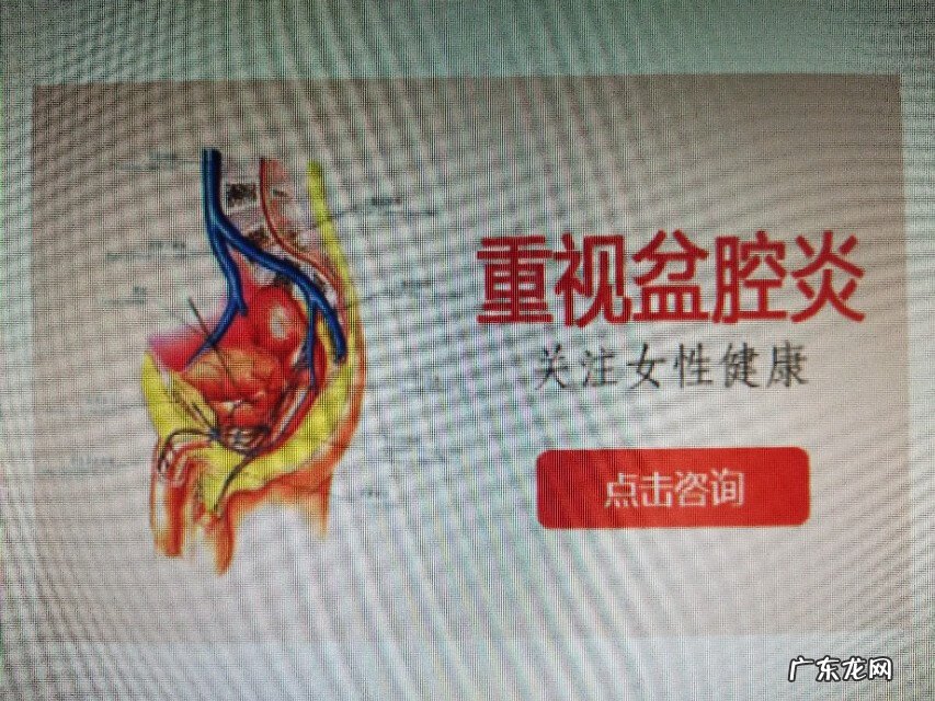 治疗盆腔炎的常用药有哪些 盆腔炎用什么药物?