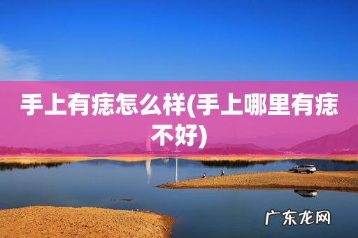 手上哪里有痣不好 手上有痣怎么样