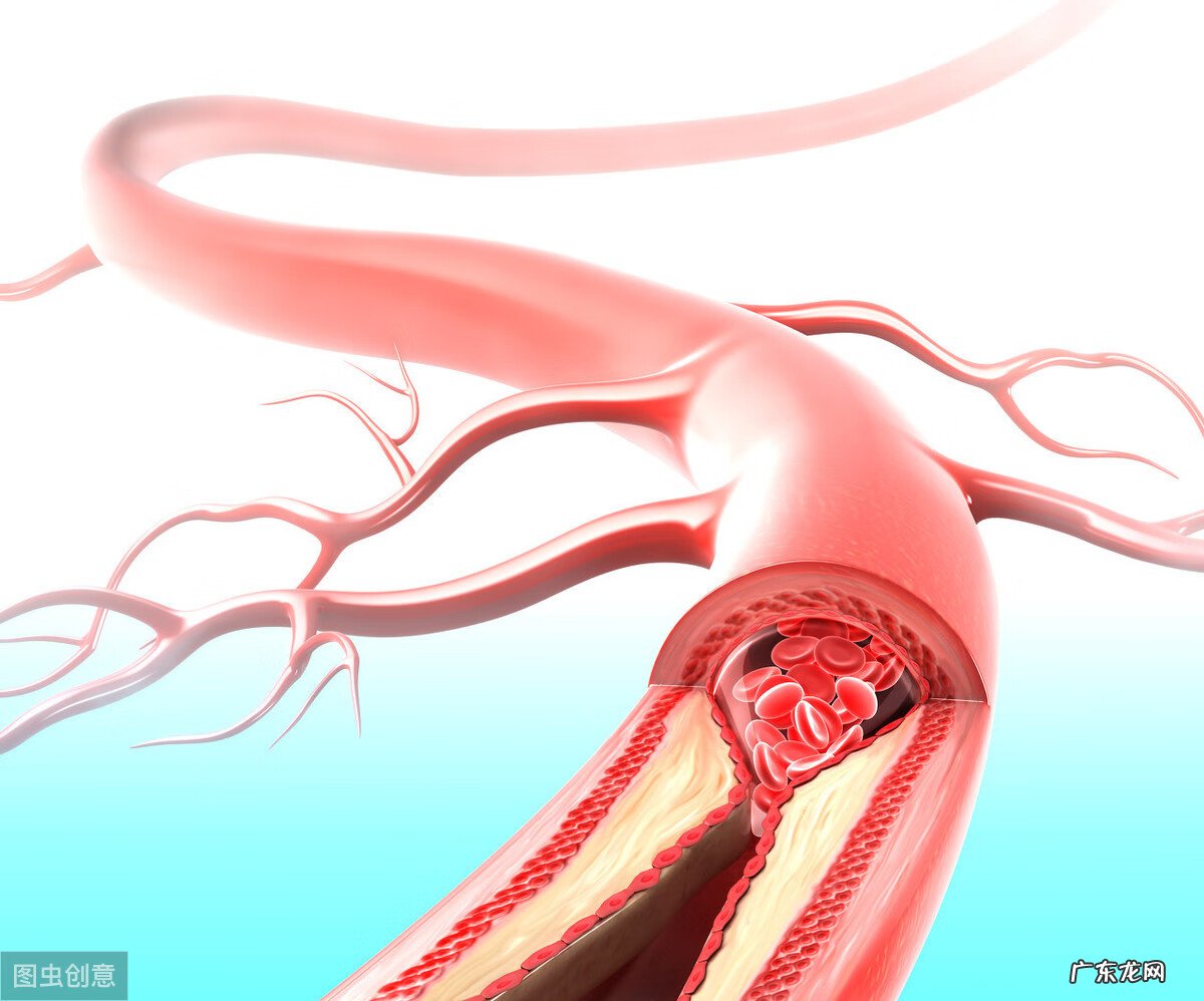 脚麻是什么原因引起的 脚麻怎么回事儿