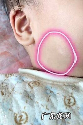 身上白块是什么 身上白块是什么原因