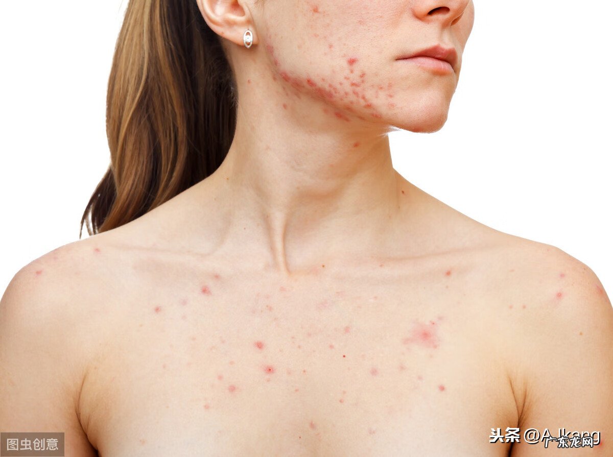 炎症有什么症状 炎症的症状表现