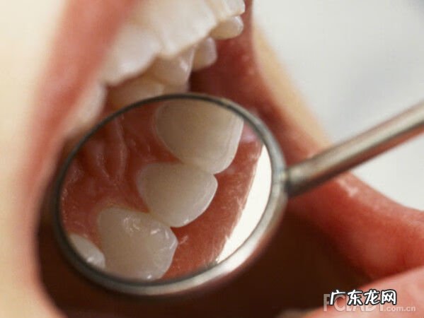 嘴苦的不行是什么问题 嘴很苦很干