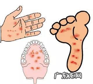 小儿手足口病是怎么引起的