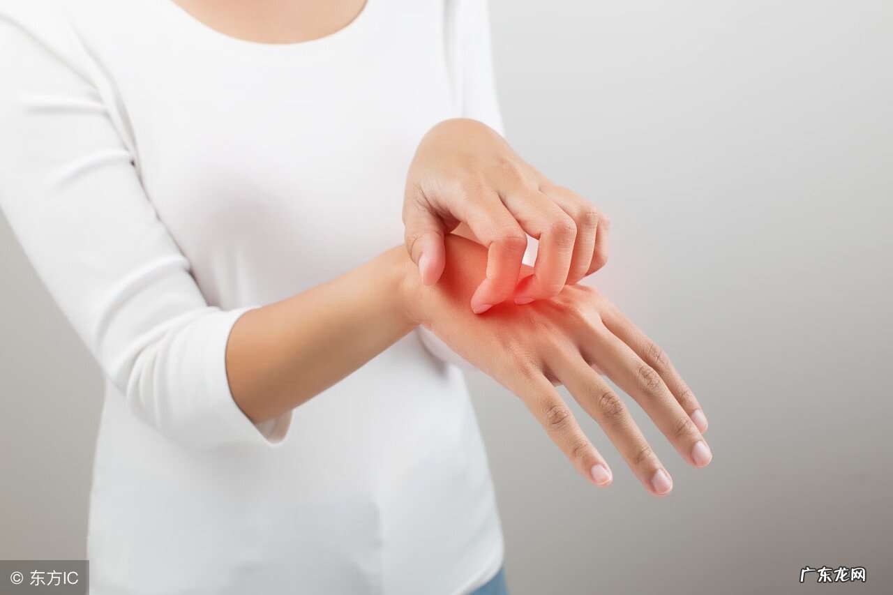 过敏性皮炎如何缓解 过敏性皮炎该怎么治疗