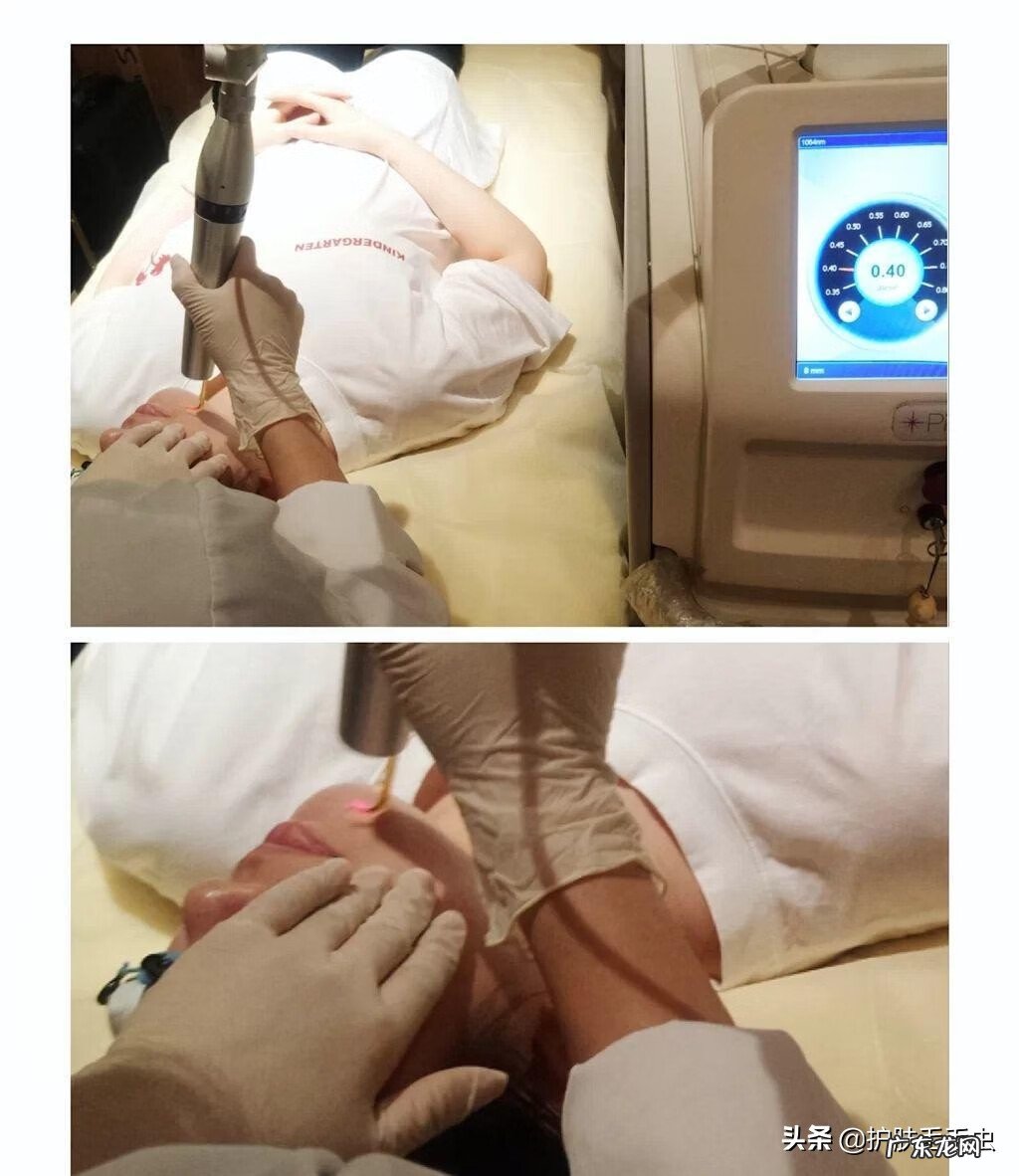 脸上突然长斑是什么原因 脸上长斑是什么原因引起的