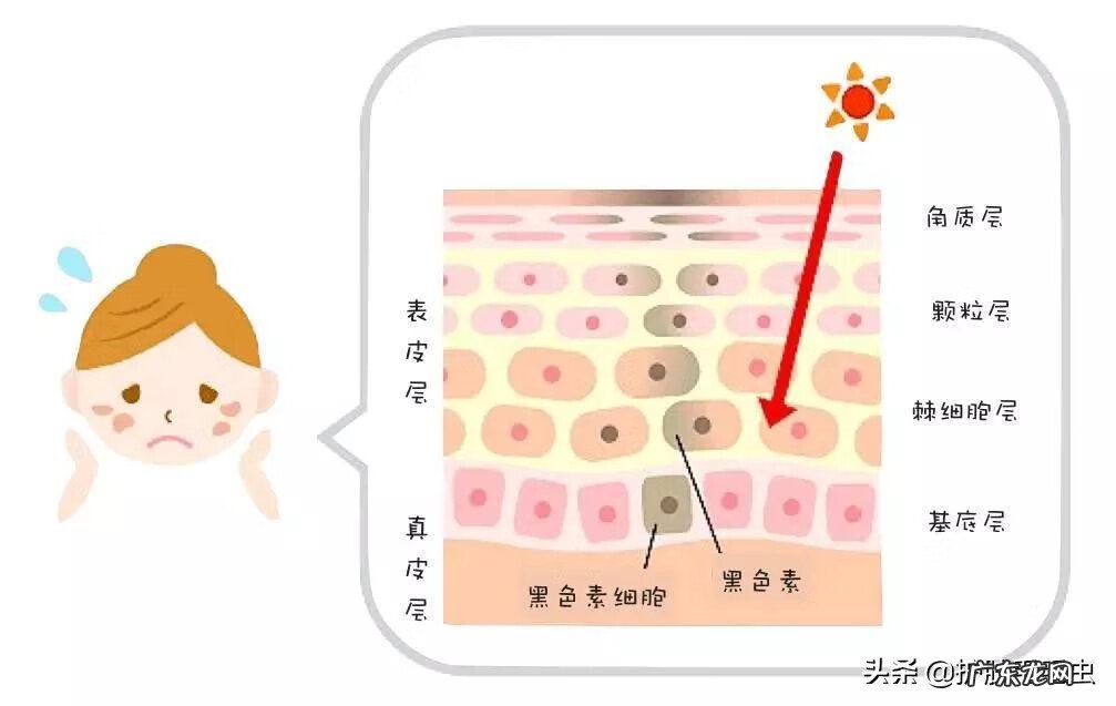 脸上突然长斑是什么原因 脸上长斑是什么原因引起的