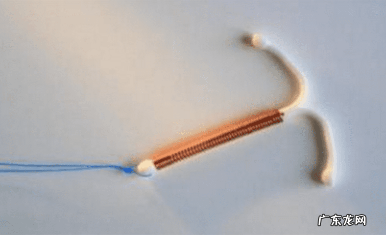 节育环图片 绝育环的作用原理