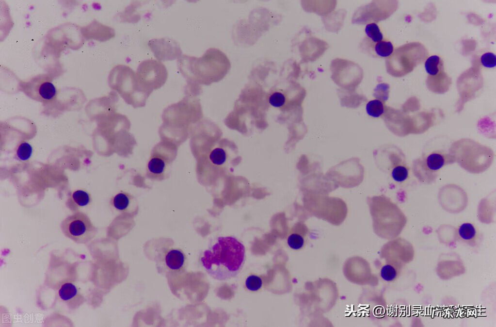 为什么叫白血病 到底什么是白血病