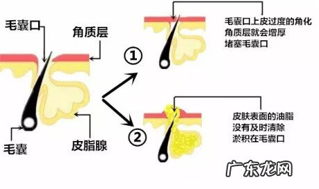 皮肤不长痘是好还是坏 不长痘代表什么