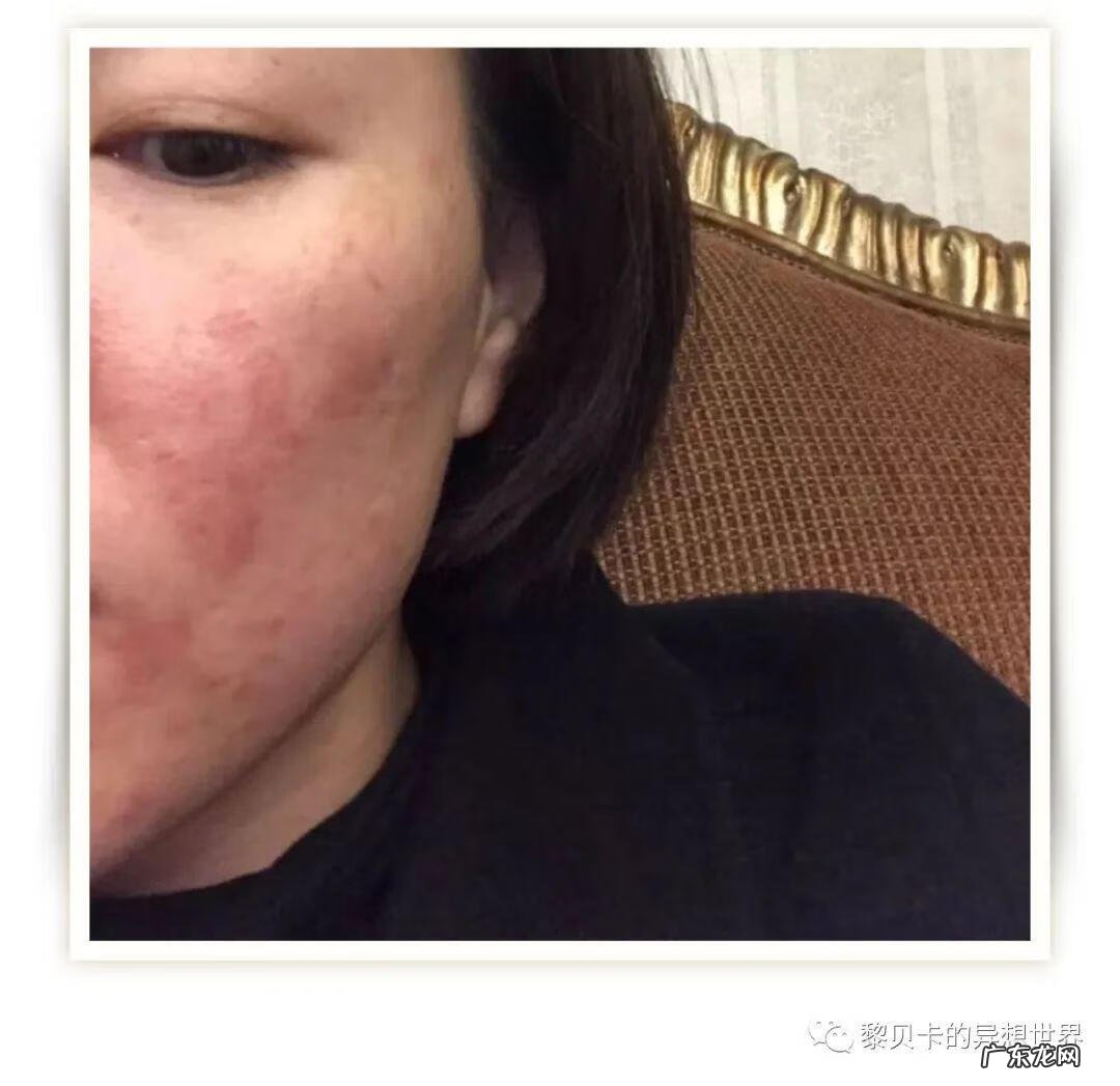 不整容脸怎么变小 改脸型修复