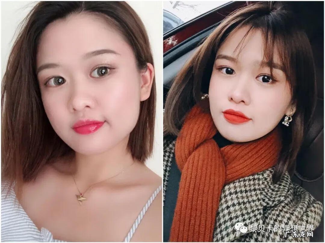 不整容脸怎么变小 改脸型修复