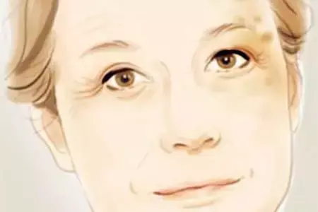 如何祛斑 怎样祛斑呢