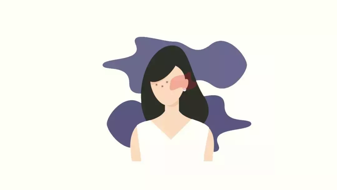 如何祛斑 怎样祛斑呢