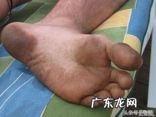 为什么脚臭,洗了也一样 去脚臭的简单小窍门