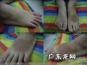 红花油的主治功能 红花油的作用与功效