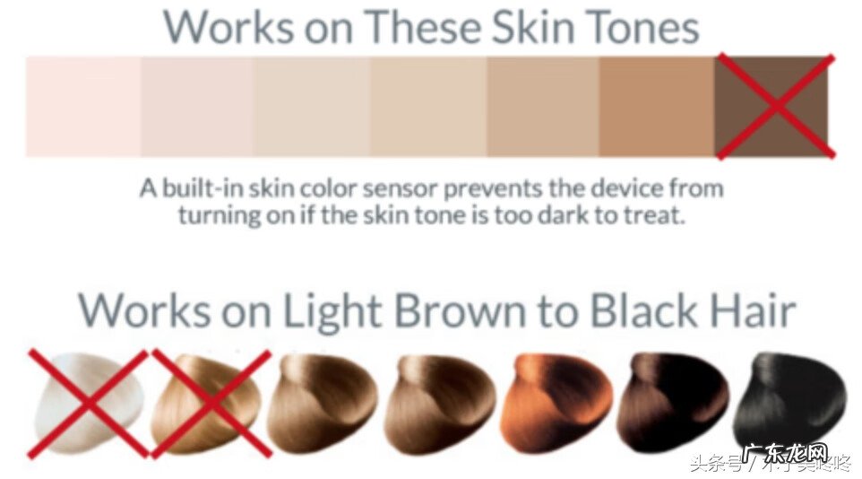 如何才可以永久脱毛 怎样能够永久脱毛