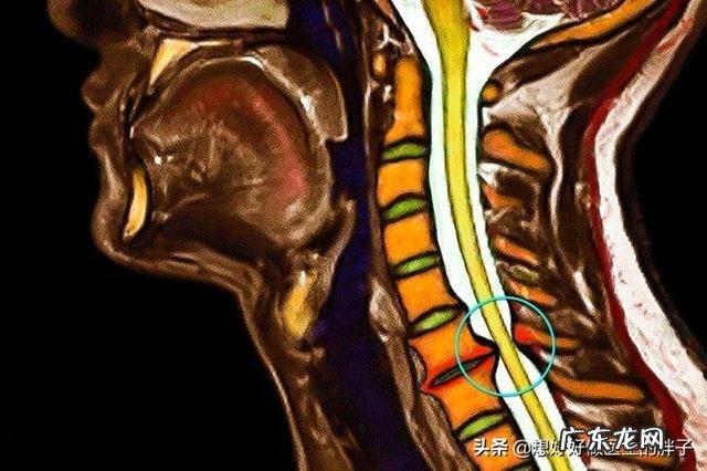 左肩胛骨疼痛是什么原因 左肩膀疼痛是什么原因引起的