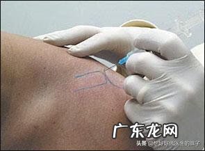 左肩胛骨疼痛是什么原因 左肩膀疼痛是什么原因引起的