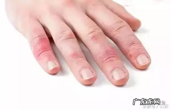 清凉油多少钱一个 清凉油价格图片