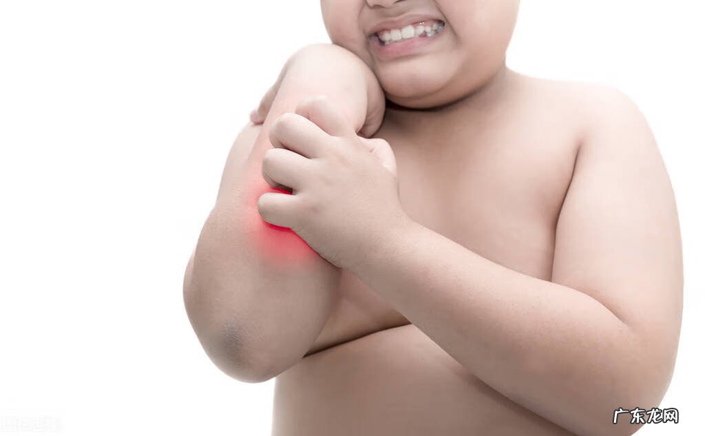 孩子起了湿疹怎么办 宝宝得了湿疹怎么办?