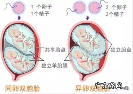 怎么样自然怀上双胞胎 生双胞胎的诀窍