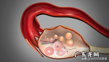 如何判断自己是否有盆腔炎 骨盆炎症