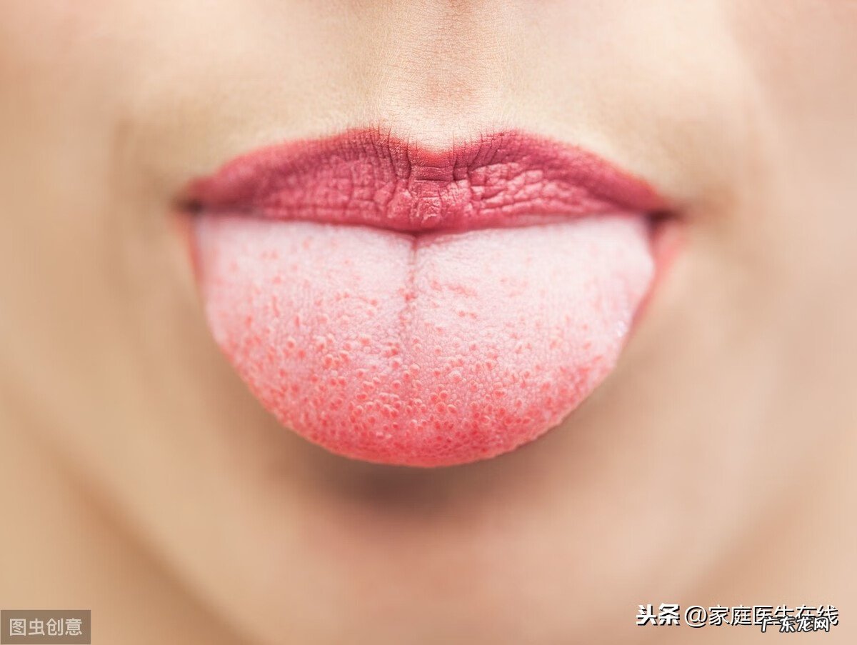 舌苔发黄怎么调理改善 舌苔发黄的原因有哪些