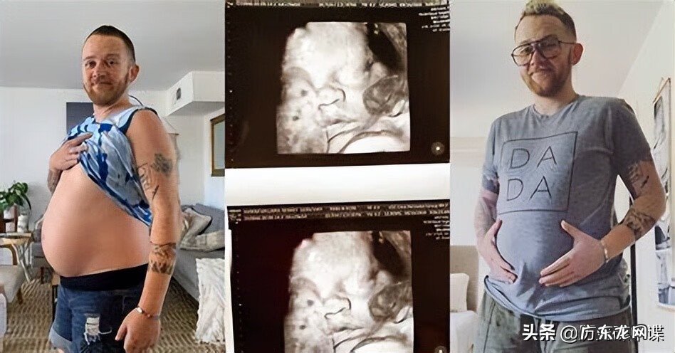 男生变性后可以生小孩吗 变性后能生孩子吗图