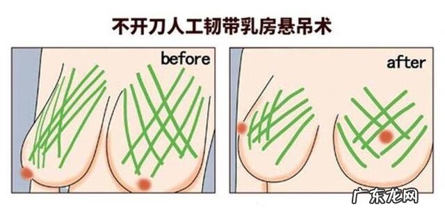 乳房下垂是什么原因 乳头下垂是什么原因造成的