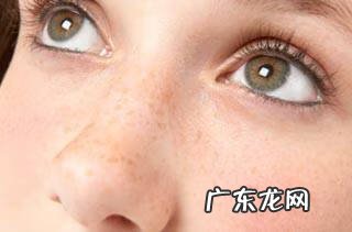 褐斑病的症状 黄褐斑症状表现