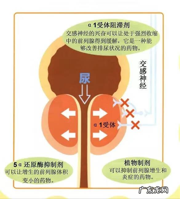 前列腺增生能彻底治愈吗 良性前列腺增生的治疗