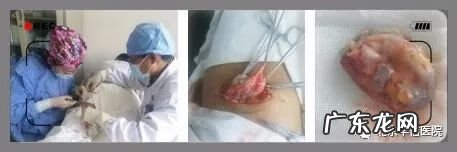 皮下囊肿是怎么回事 皮下囊肿图片