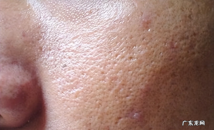 男生保养脸部皮肤步骤 男士脸部皮肤保养方法