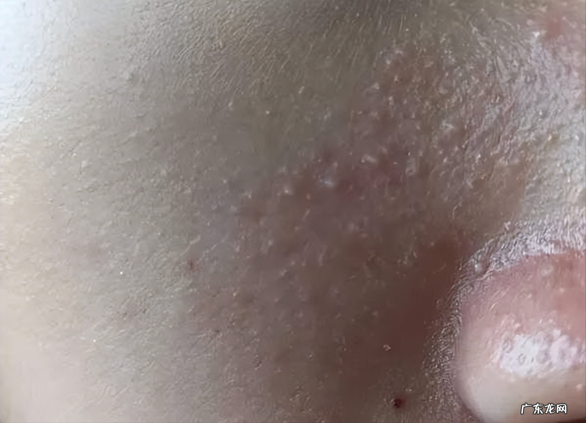 男生保养脸部皮肤步骤 男士脸部皮肤保养方法